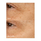 CLINIQUE Smart Clinical Repair Overnight Recovery Cream + Mask (50 ml)