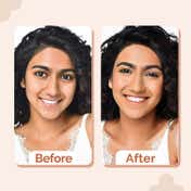 The Derma Co 1% Hyaluronic Hydrating  High Coverage Foundation with SPF 40 PA+++ - Caramel (18 ml)