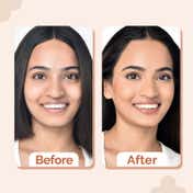 The Derma Co 1% Hyaluronic Hydrating  High Coverage Foundation With SPF 40 PA+++ - Natural(18 ml)