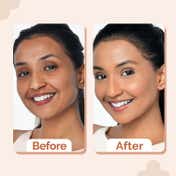 The Derma Co 1% Hyaluronic Hydrating  High Coverage Foundation With SPF 40 PA+++ - Cinnamon (18 ml)