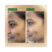Ras Luxury Skincare Brightening & Anti Pigmentation Advanced Booster Serum (10 ml)