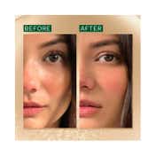 Ras Luxury Skincare Anti-Aging & Retexturizing Advanced Booster Serum (10 ml)