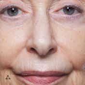 Allies Of Skin Multi Acids & Retinoid Brightening Sleeping Facial (48 ml)