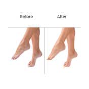 O3+ Pedilogix Scoop Bomb Pedicure With Bath Bomb For Soft and Moisturised Feet (110 g)