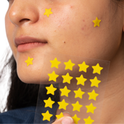 Gush Beauty Dart It Hydrocolloid Pimple Patches for Healing Acne, Zits and Blemishes - Super Star