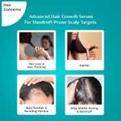 Pilgrim 3% Redensyl & 4% Anagain Advanced Hair Growth Serum (30 ml)