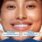 Aqualogica 5 Barrier+ Hydra Gel Moisturizer With Avocado & 5 Essential Ceramides (100 g)