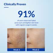 Fixderma Skarfix -TX Cleanser Kojic Acid Niacinamide  For Dark Spots Exfoliators Face Wash (75g)