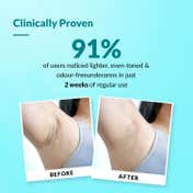 Fixderma Nigrifix Underarm Ocean Roll on With 6% AHA, Lactic Acid & 1% Mandelic Acid Deodorant (60ml)