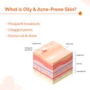 The Derma Co 1% Hyaluronic Sunscreen Oil-Free Gel Lightweight Sunscreen Acne-Prone Skin (50 g)