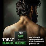Beardo B-Acne Clear Bathing Bar (75 g)
