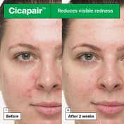 Dr.Jart+ Cicapair So Soothing Treatment Gel Cream with Centella Asiatica (30 ml)