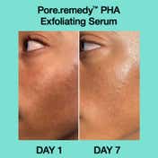 Dr.Jart+ Pore Remedy PHA Exfoliating Serum Gentle Smoothing Serum for Blackheads Oil Control (30 ml)