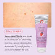 First Aid Beauty KP Bump Eraser Body Scrub 10% AHA Strawberry (56.7 g)