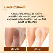 Fixderma Foobetik Foot Scrub Spray Dead Skin & Tan Removal Darkness Blackness Removal Scrub (50ml)