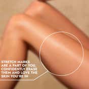 COS-IQ Stretch Marks Removal Roll-On Serum (40 ml)