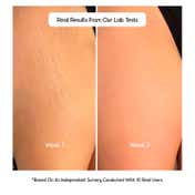 COS-IQ Stretch Marks Removal Roll-On Serum (40 ml)