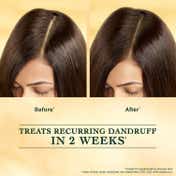 Indulekha Svetakutuja Dandruff Treatment Ayurvedic Hair Serum (30 ml)