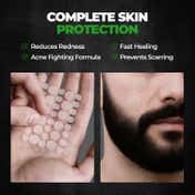 Beardo Acne Pimple Patch (72 patches)