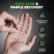 Beardo Acne Pimple Patch (72 patches)