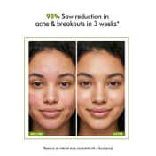 Conscious Chemist Flashfix Acne Spot Corrector Face Cream With 2% Salicylic Acid & Bio-Actives (50 g)