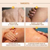 mCaffeine 7% Exfoliating and 1% Salicylic, 2% Lactic Acid Body Wash for Body Acne Reduce (300 ml)