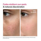 WishCare Advanced Dark Spot Correcting TXA Shot Serum, Alpha Arbutin & Niacinamide (30 ml)