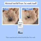 WishCare Multi Peptide Anti Hairfall Shampoo with Rosemary Boosts Hair Growth (120 ml)