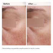 The Ordinary Niacinamide 5% Face & Body Emulsion (100 ml)
