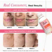 The Pink Foundry Dark Spot & Hyperpigmentation Face Serum (15 ml)