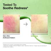 Anua Azelaic Acid 10 Hyaluron Redness Soothing Serum (30 ml)