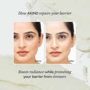 Akind Bright Idea Radiance Serum (30ml), Brightening & Fading Pigmentation with 10% Vit C