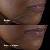 CLINIQUE Smart Clinical Repair Lifting Face + Neck Cream (50 ml)