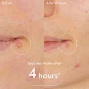 Caudalie Vinopure Salicylic Spot Solution (15ml)