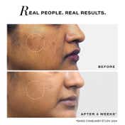 Novology Pigmentation Reduction Moisturiser for Dark Spots,Acne Marks & Blemishes,Dermat Tested (50g)