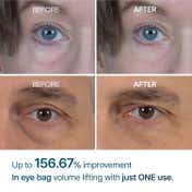 Dr.Melaxin Eyephalt Eyebag Cream (10 g)