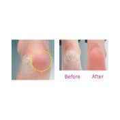 Babila Callus Rechargeable Remover - CR-E01 - White & Pink