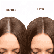 Beauty Garage Scalp Sense Leave In Treatment (60 ml)