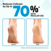 Vega Pumice Stone for Feet, Foot Scrubber for Dead Skin Removal (PD-29)