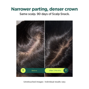 RESOLVE Scalp Snack Hair Growth & Scalp Renewal Serum (50 ml)