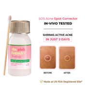 The Pink Foundry Overnight Acne Spot Corrector (30ml)