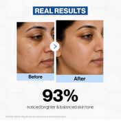 FCL Exo-Radiance Serum Exosomes for Hyperpigmentation, Even Skin (50 ml)