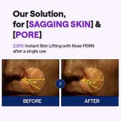 MEDIHEAL PDRN Lifting Serum (40 ml)
