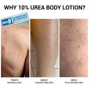 Sereko 10% Urea Body Lotion with Avocado Oil 48H Hydration for Dry Skin (200 ml)