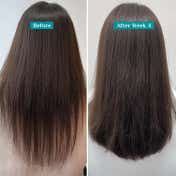 Pilgrim Redensyl & Anagain Hairfall Control Shampoo with Hair Growth Boosters (400 ml)