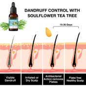 Soulflower Teatree Essential Oil (15ml)