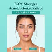 The Face Shop Dr Belmeur Korean Gel Cleanser for Acne with Salicylic Acid, AHA BHA (100 ml)
