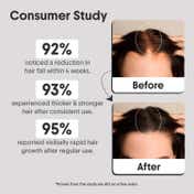Aravi Organic Advanced Hair Growth Serum (30ml)