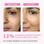 Hyphen Advanced De-Pigmentation Serum (30 ml)