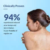 Fixderma 2% Salicylic Acid Salyzap Body Acne Spray for Acne on Back Shoulders and Chest (50 ml)